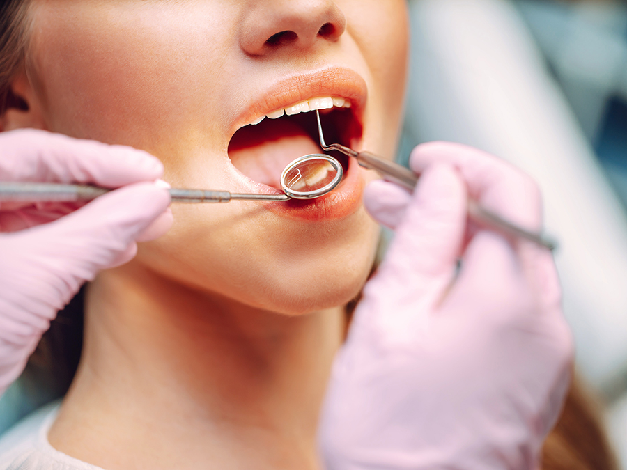 Dental Checkups