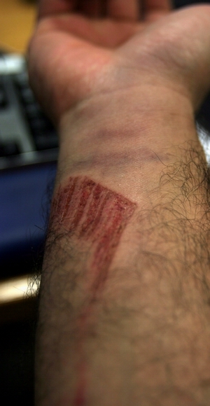Tool-related injuries - Fine Homebuilding