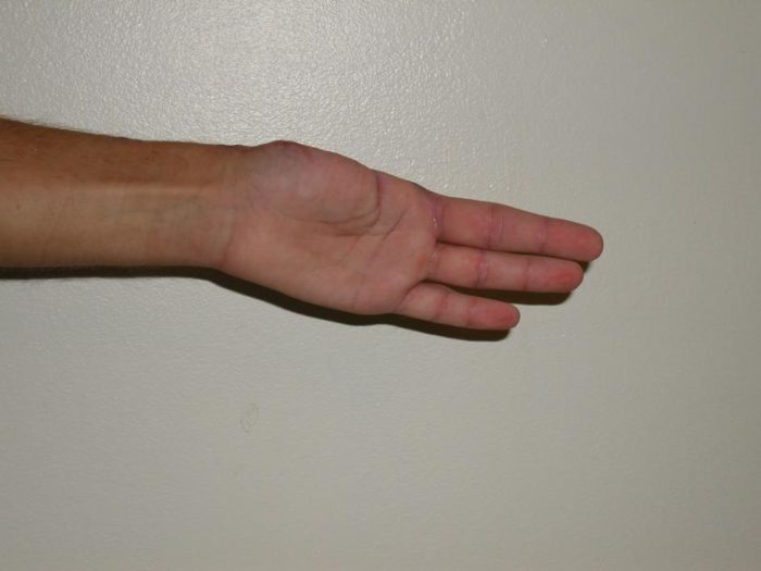 Ran My Thumb Through the Jointer FineWoodworking