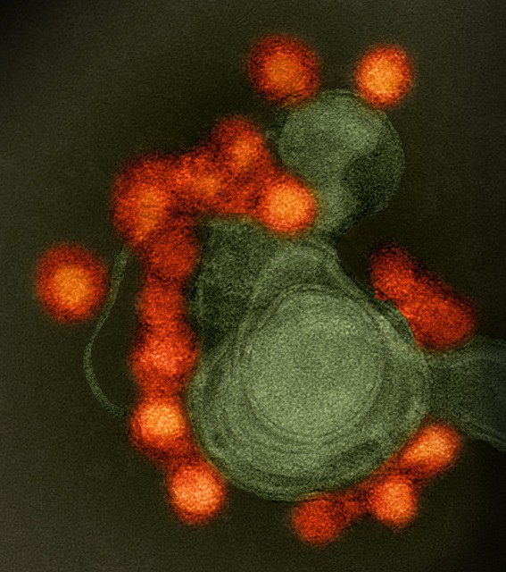 ZIKA Virus
