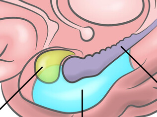 report graphic thumbnail