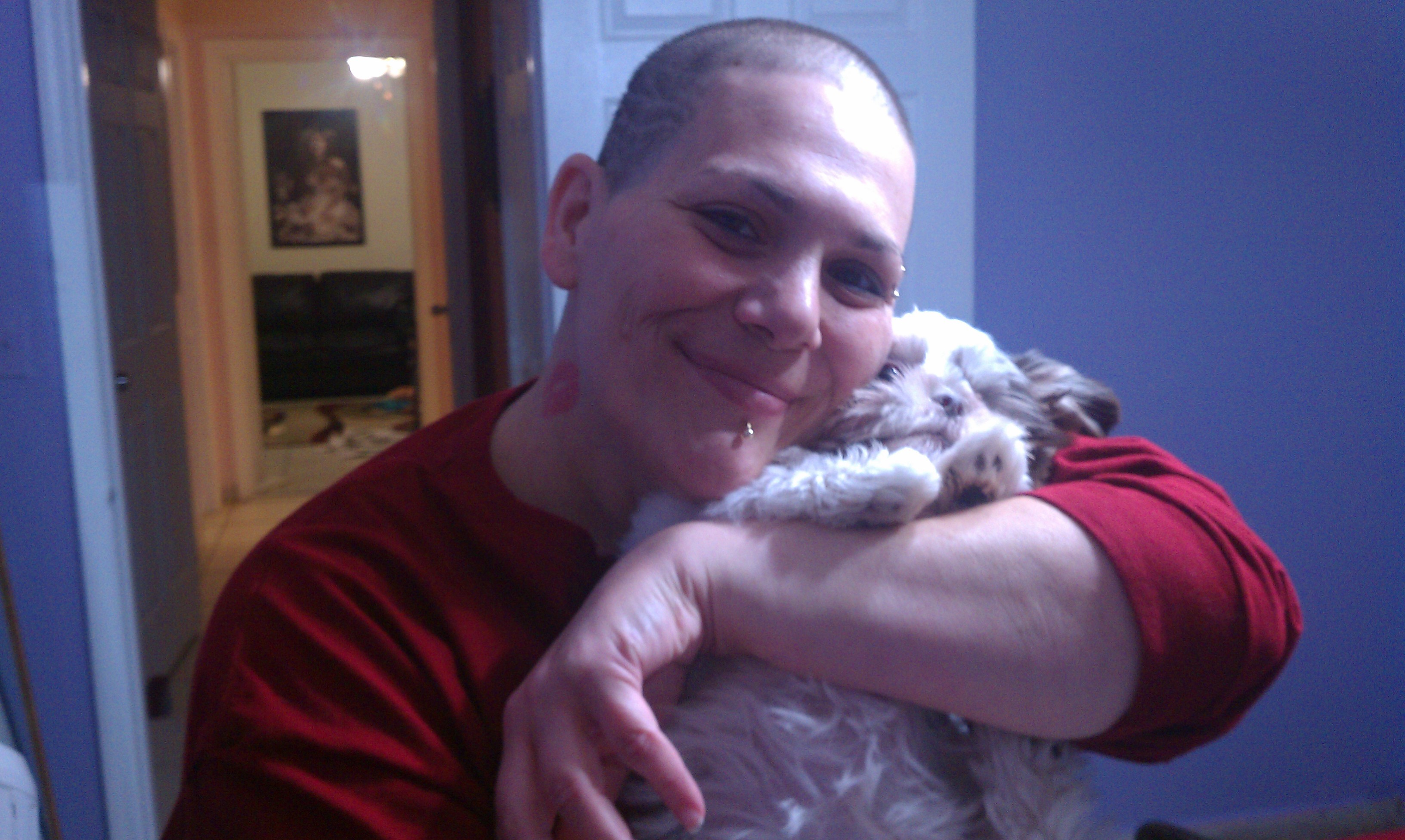 Gastric Bypass Hell!! Gastric Bypass gone w... Fundly