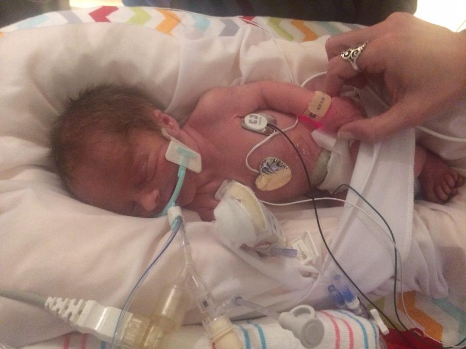 TeamJJ Preemie Gastroschisis Baby Fundly teamjj-preemie-gastroschisis-baby-fundly