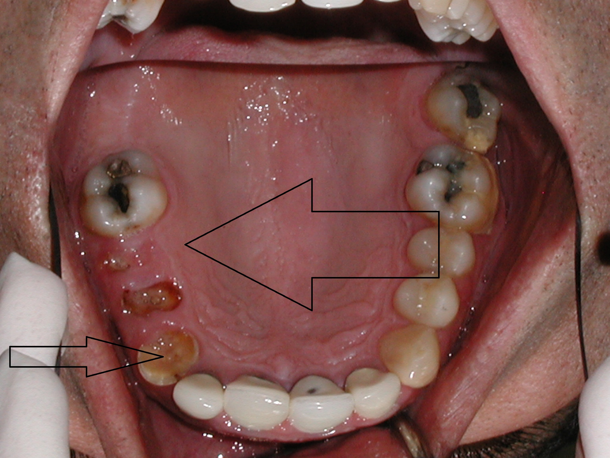 Saving my life. | Fundly