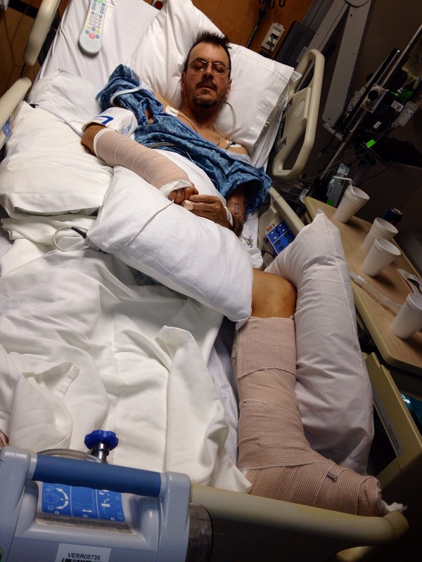 After two of several surgeries. After two of several surgeries.