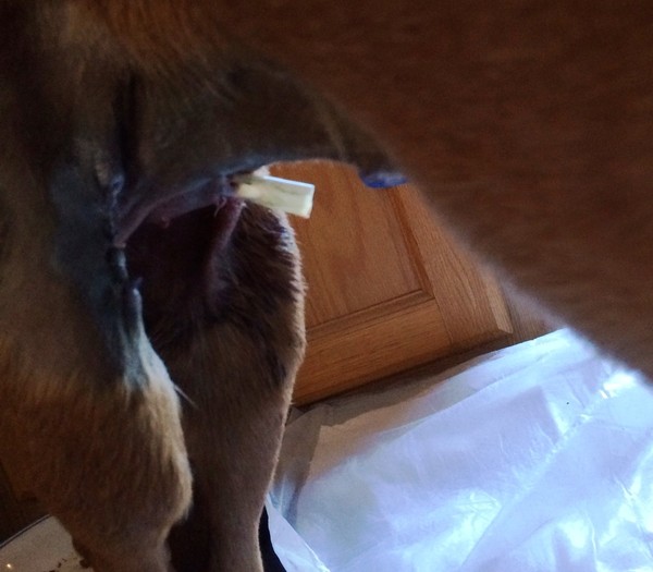 Cagney after initial surgery Cagney after initial surgery