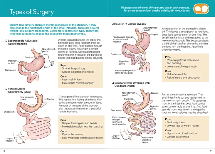 American Society For Metabolic And Bariatric Surgery