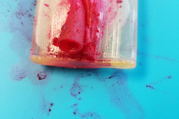 Surgical Incision and dissection planes model