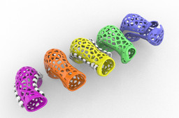 3D printed cast for the Ponseti Method