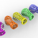 3D printed cast for the Ponseti Method