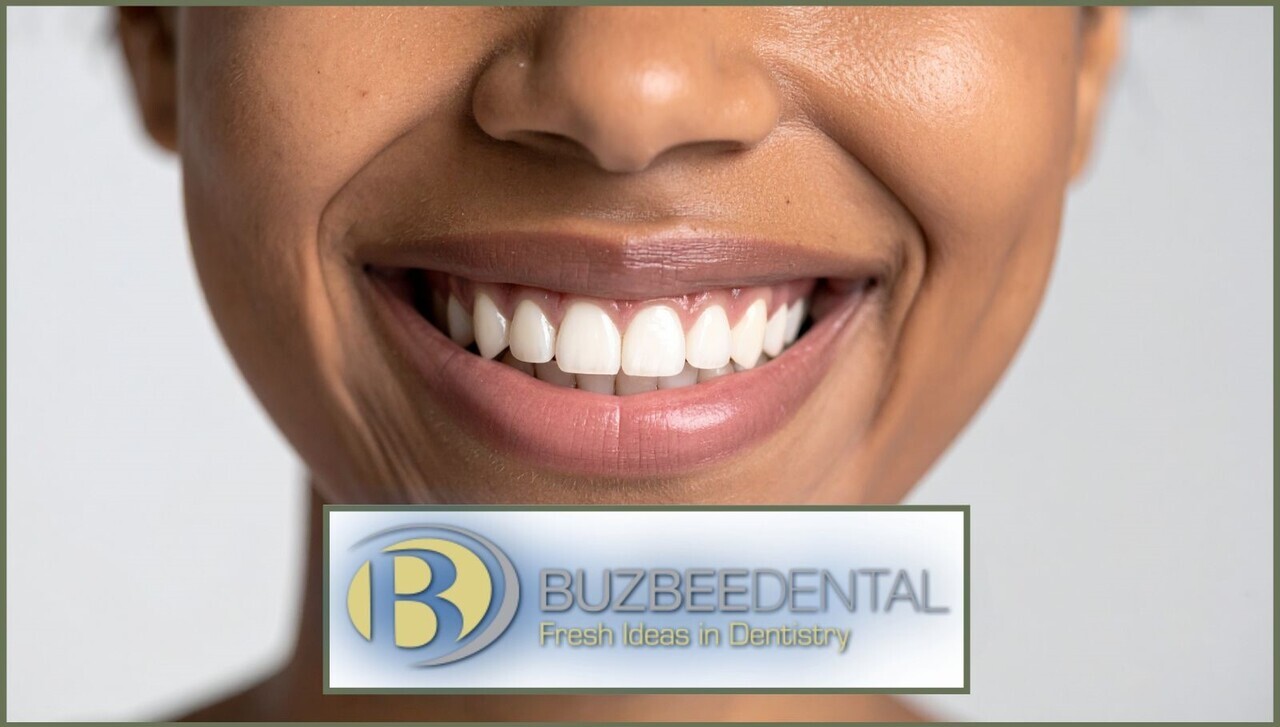 Dental Whitening Treatment auction item image