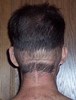 Scar_thumb