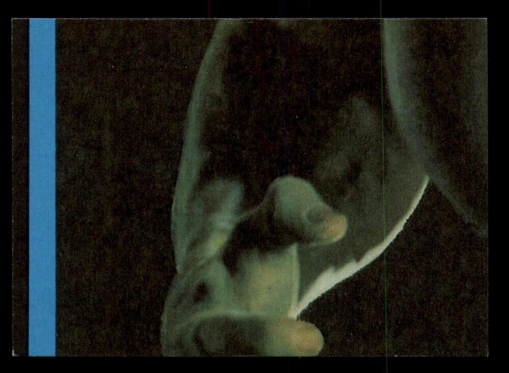 1979 Topps Incredible Hulk - Complete your set - Pick your card - Picture 21 of 193