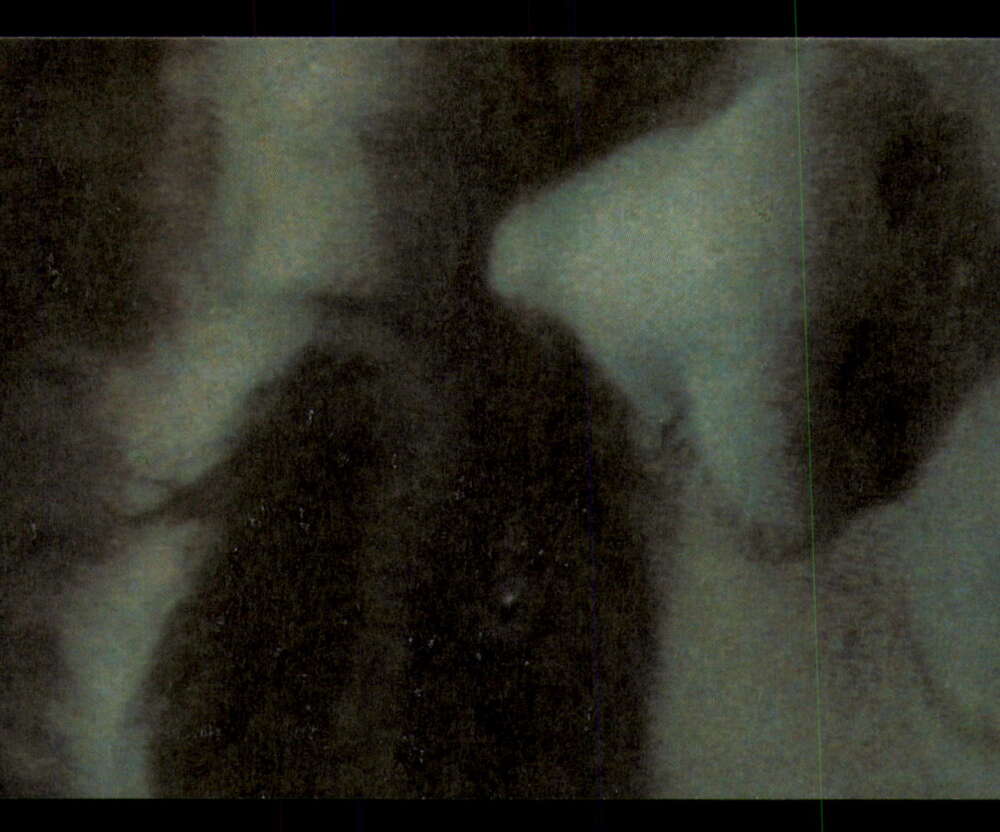 1979 Topps Incredible Hulk - Complete your set - Pick your card - Picture 37 of 193