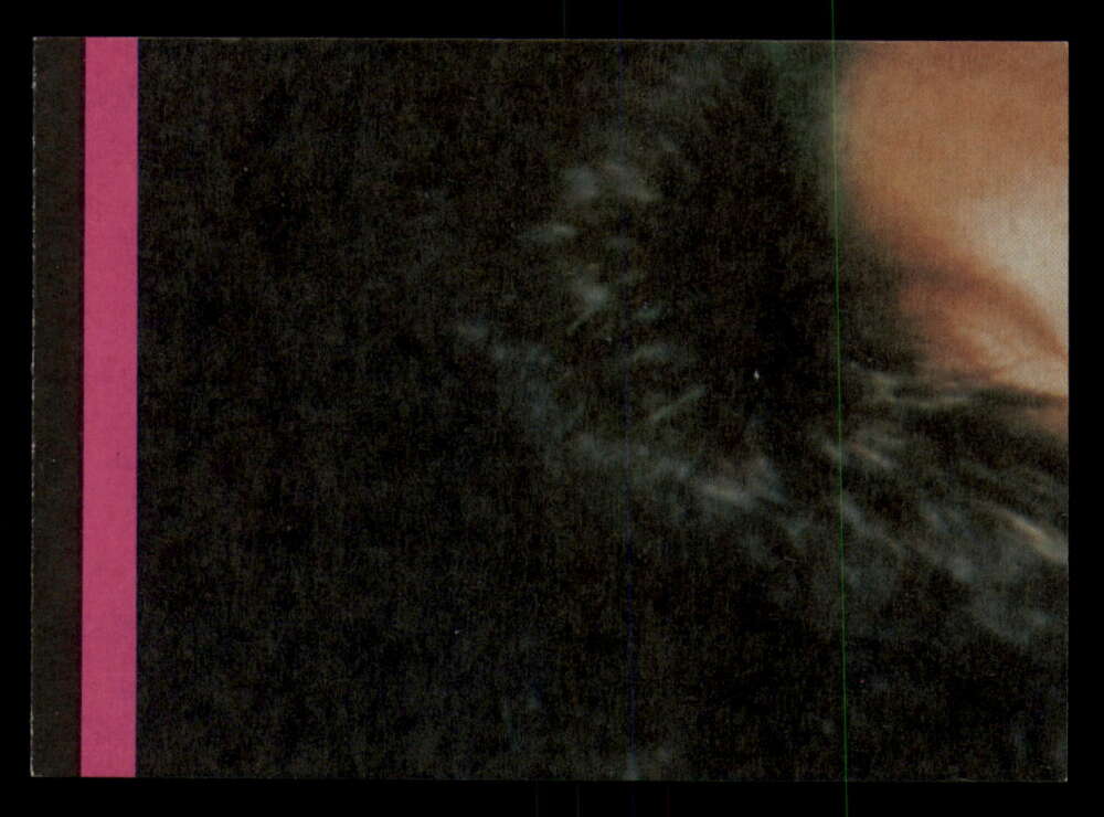 1979 Topps Incredible Hulk - Complete your set - Pick your card - Picture 59 of 193