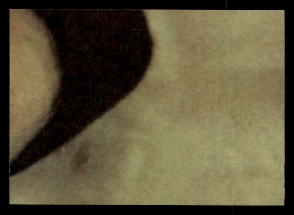 1979 Topps Incredible Hulk - Complete your set - Pick your card - Picture 81 of 193