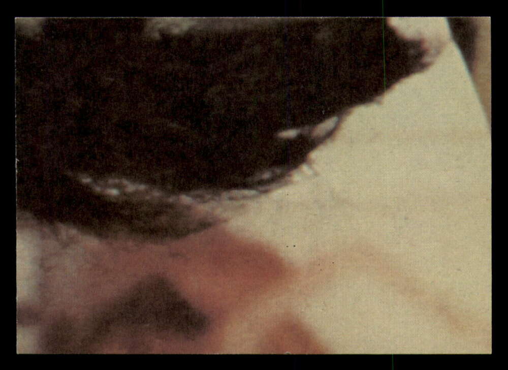 1979 Topps Incredible Hulk - Complete your set - Pick your card - Picture 91 of 193