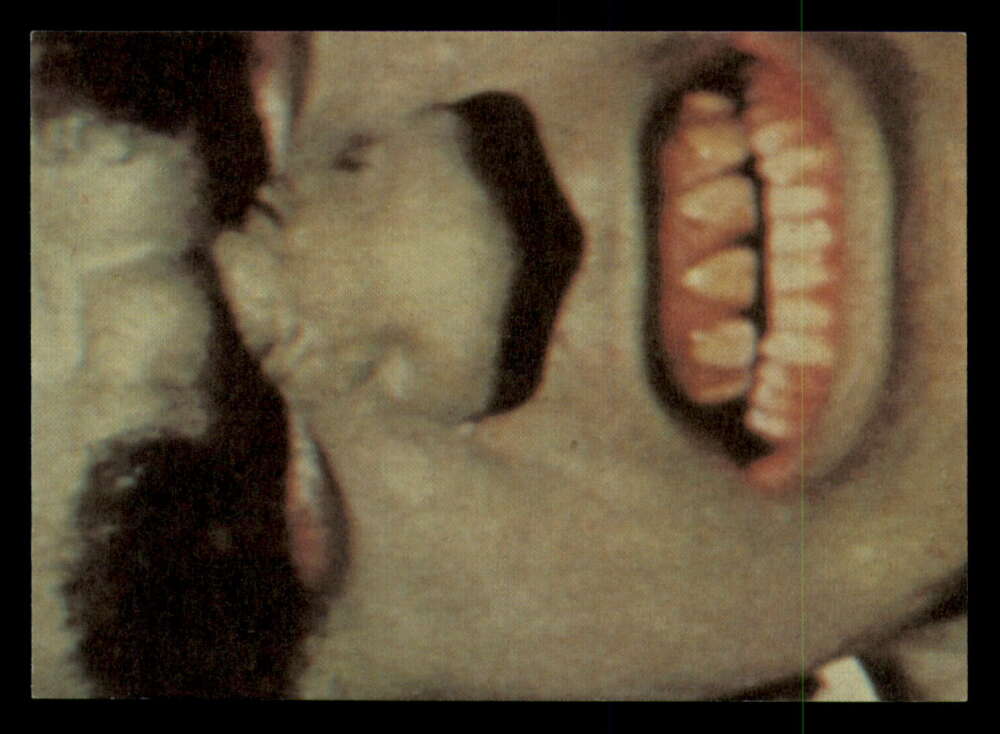 1979 Topps Incredible Hulk - Complete your set - Pick your card - Picture 177 of 193