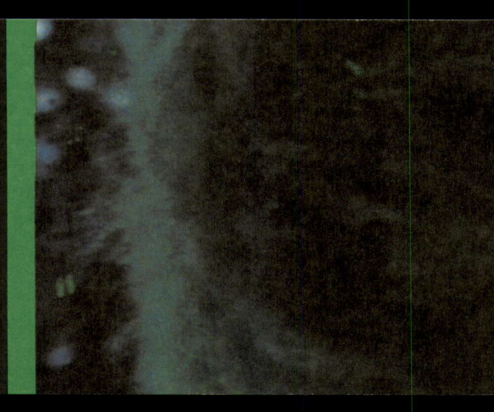 1979 Topps Incredible Hulk - Complete your set - Pick your card - Picture 181 of 193