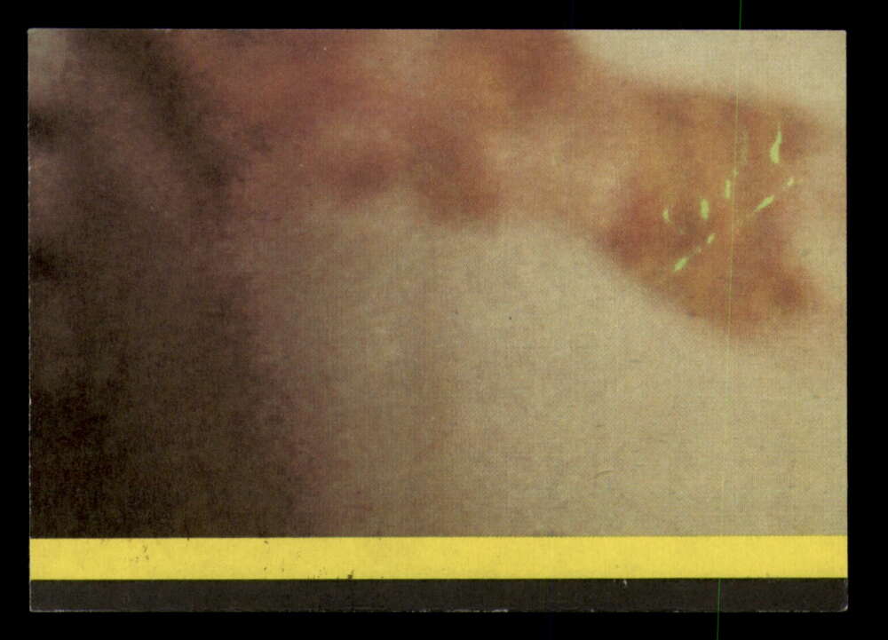 1979 Topps Incredible Hulk - Complete your set - Pick your card - Picture 185 of 193