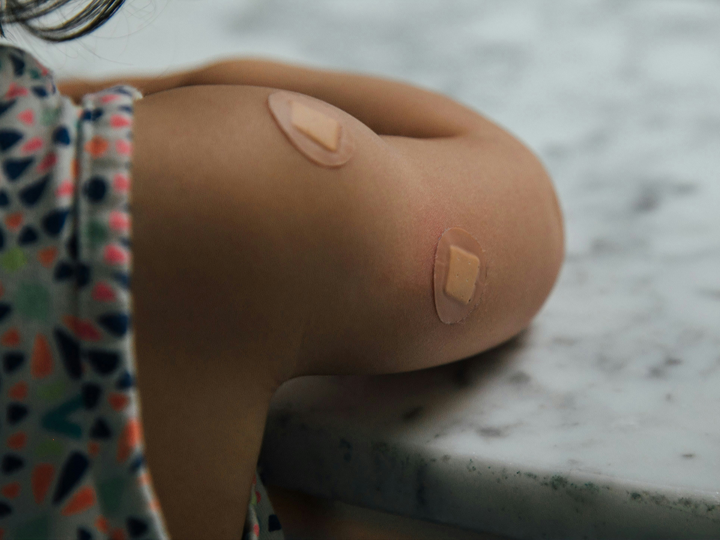 A child's arm with two band-aids