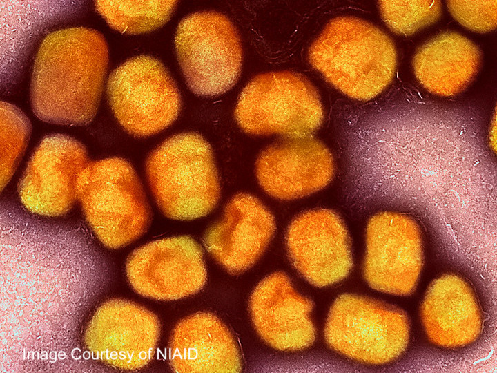 Monkeypox virus