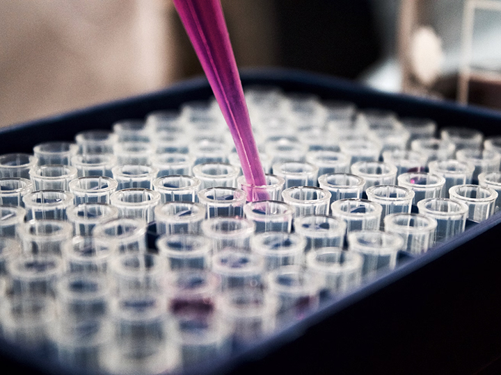 Global health development