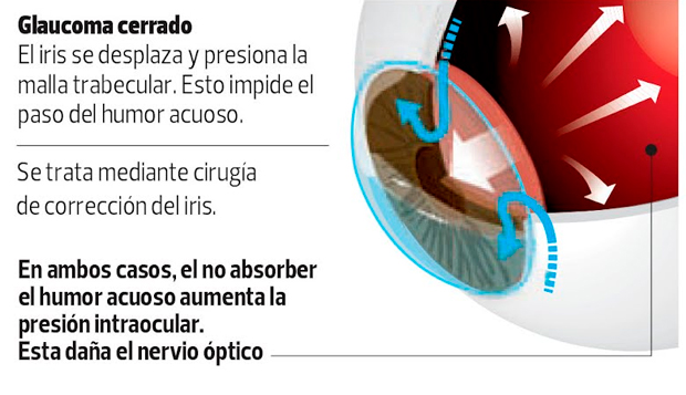 elpopular.pe