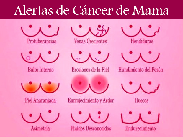 elpopular.pe