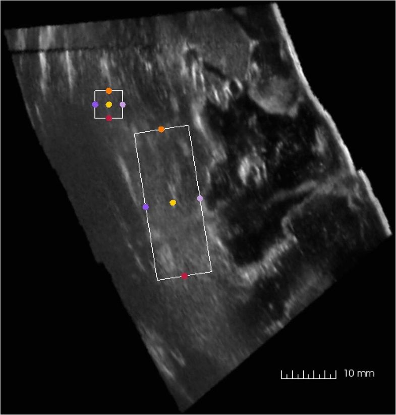 A new acoustic coupling fluid with ability to reduce ultrasound imagin