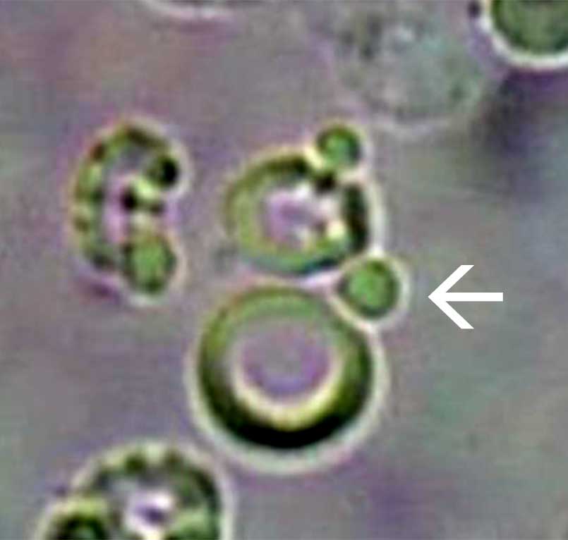 Quality in Urine Microscopy The Eyes of the Beholder
