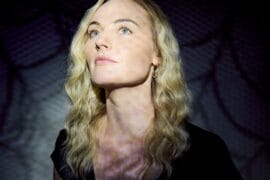 First Robin, “Spider Veins”