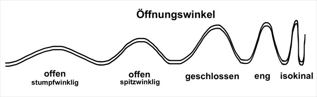 Oeffnungswinkel
