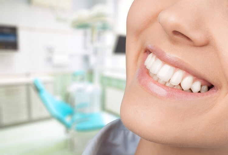 clareamento Clareamento dentário