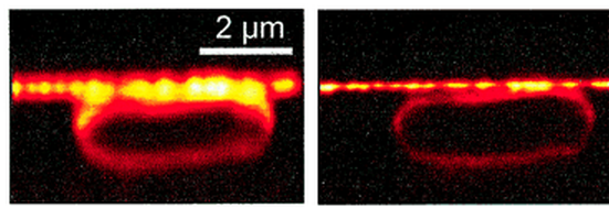 E.Coli Sted microscopy