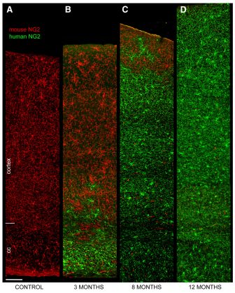 Human brain cells are more powerful that mouse brain cells -HeadStuff.org