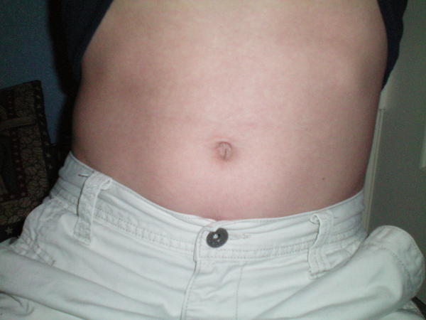 side pain near ribs during pregnancy