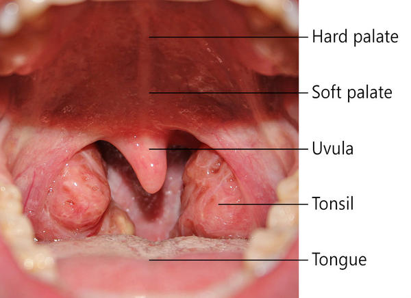 mono tonsils