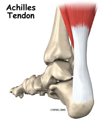 Levaquin Lawsuits - Tendon Rupture and.
