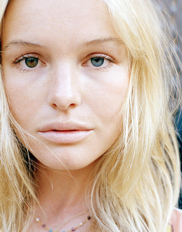Human Heterochromia