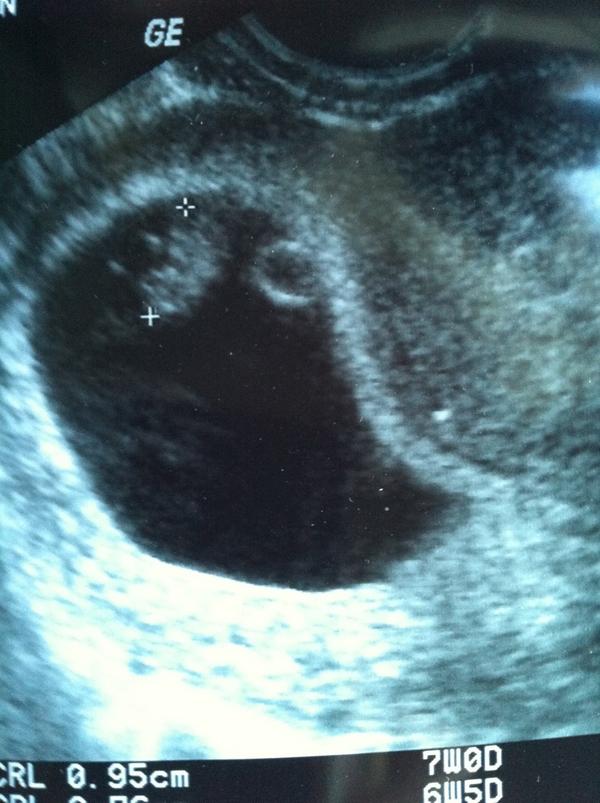 old man piss on teen ultrasound dating third trimester