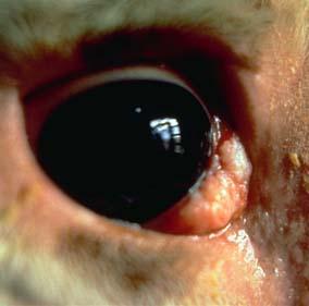 Eye Cancer Symptoms