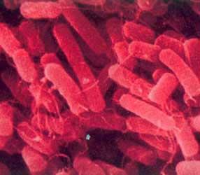 Gram Stain Klebsiella