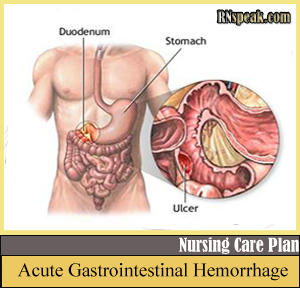 black stool diarrhea