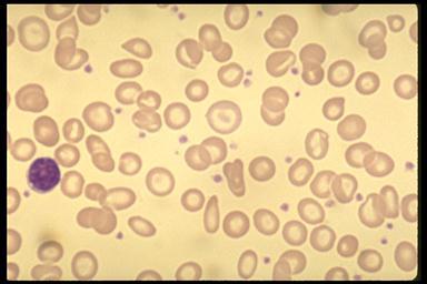 how to do manual platelet count