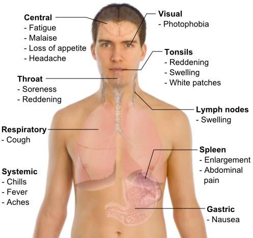 dizziness nausea vomiting   cervical fusion