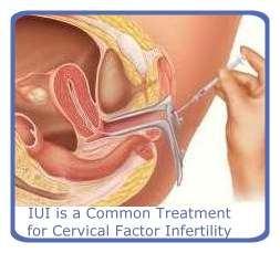 Robitussin Cough Gels
