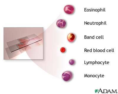 types of wbc