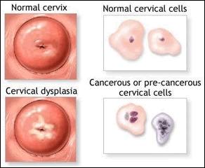 Hpv In Men