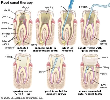 Dental Mouth Prop
